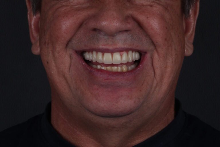 Alberto Implantes