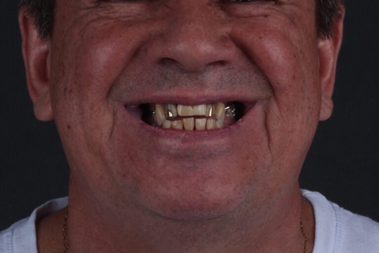 Alberto