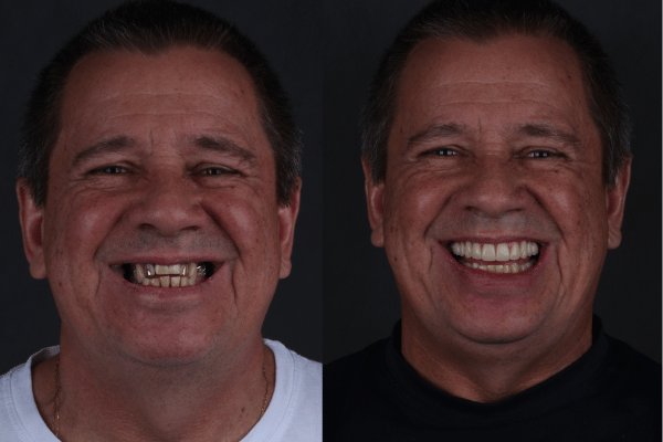 albertoantesdepois