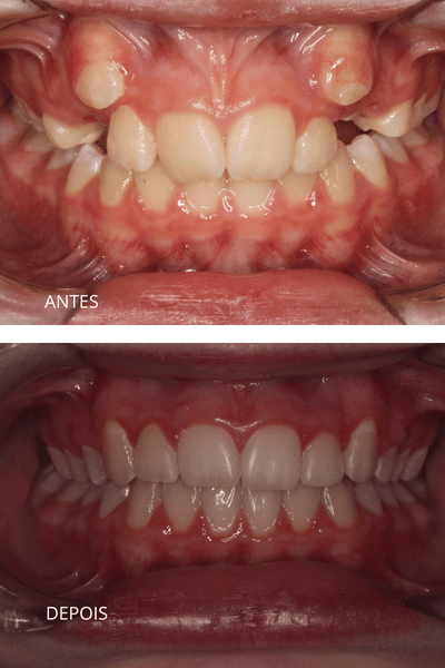 antesdepoismariana e1782500463457